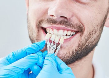 A man using a tooth shade selector at the dentist