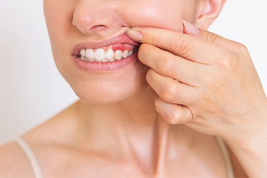 Treat gum disease and protect your smile near Glastonbury Center